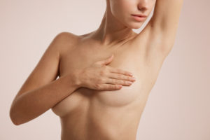 Breast up-lift (Mastopexy)